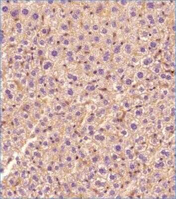 Immunohistochemistry-Paraffin: ABCA1 Antibody (1276B) - Azide and BSA Free [NBP2-80556]