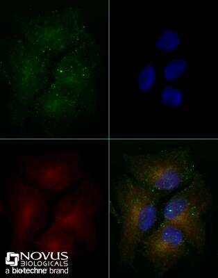 Immunocytochemistry/ Immunofluorescence: ABCA1 Antibody (1276B) - BSA Free [NBP2-54792]