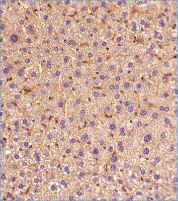 Immunohistochemistry-Paraffin: ABCA1 Antibody (1276B) - BSA Free [NBP2-54792]