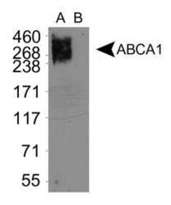 Western Blot: ABCA1 Antibody (3A1.891.3) [NB400-164]