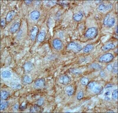 Immunohistochemistry: ABCA1 Antibody (HJ1) - Azide and BSA Free [NBP2-80554]