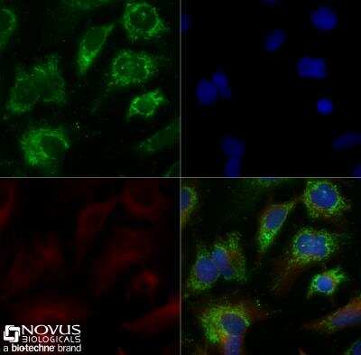 Immunocytochemistry/Immunofluorescence Staining of ABCA1 in HepG2 Cells
