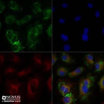 Immunocytochemistry/Immunofluorescence Staining of ABCA1 in HepG2 Cells