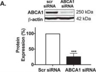 Knockdown Validation of ABCA1 Antibody in Transfected HSKMCs by Western Blot