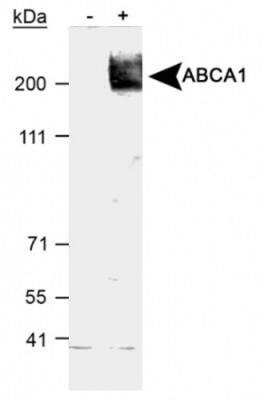Western Blot Detection of ABCA1 in Treated and Vehicle RAW264.9 Cell Lysates