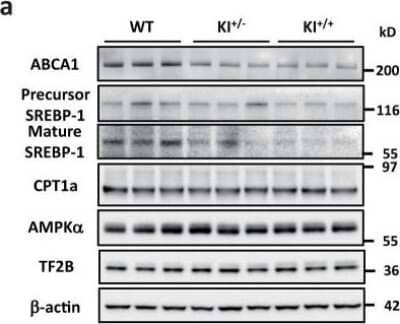 Western Blot Analysis of ABCA1 in the Livers of WT, KI+/-, and KI+/+ Mice