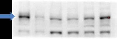 Western Blot Detection of ABCA1 in Human Primary Fibroblasts