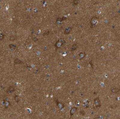 Immunohistochemistry-Paraffin: ABCA10 Antibody [NBP1-83953]