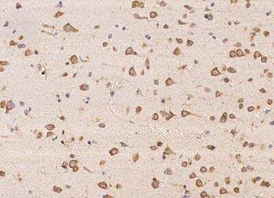 Immunohistochemistry-Paraffin: ABCA10 Antibody [NBP3-05791]