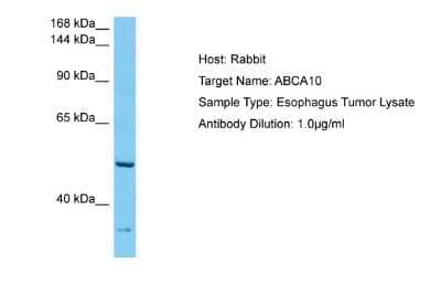 Western Blot: ABCA10 Antibody [NBP2-82544]