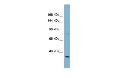 Western Blot: ABCA13 Antibody [NBP2-82545]