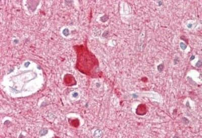 Immunohistochemistry-Paraffin: ABCA2 Antibody [NBP1-20863]