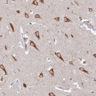 Immunohistochemistry-Paraffin: ABCA2 Antibody [NBP2-14249]