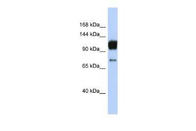 Western Blot: ABCA2 Antibody [NBP2-84371]