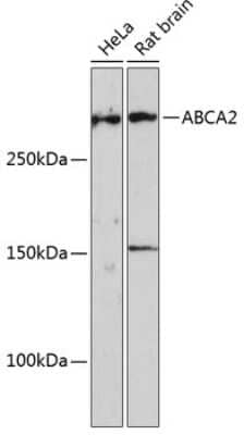 Western Blot: ABCA2 AntibodyAzide and BSA Free [NBP2-92339]