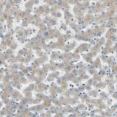 Immunohistochemistry-Paraffin: ABCA3 Antibody [NBP1-89310]