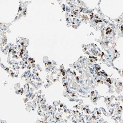 Immunohistochemistry-Paraffin: ABCA3 Antibody [NBP1-89310]