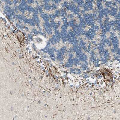 Immunohistochemistry-Paraffin: ABCA3 Antibody [NBP1-89310]