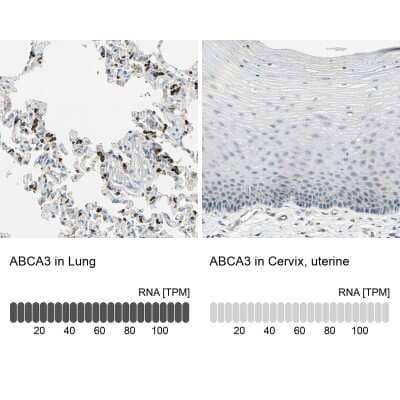 Immunohistochemistry-Paraffin: ABCA3 Antibody [NBP1-89310]