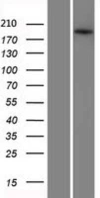 Western Blot: ABCA3 Overexpression Lysate [NBP2-08442]