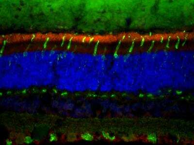 Immunohistochemistry-Frozen: ABCA4 Antibody (3F4) [NBP1-30032]