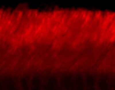 Immunohistochemistry: ABCA4 Antibody (3F4) [NBP1-30032]