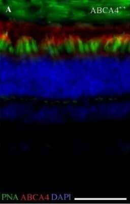Immunohistochemistry: ABCA4 Antibody (3F4) [NBP1-30032]
