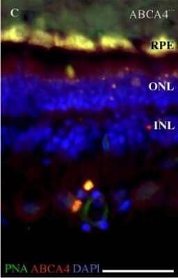 Knockout Validated: ABCA4 Antibody (3F4) [NBP1-30032]