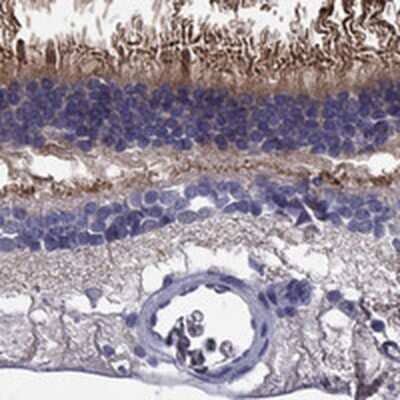 Immunohistochemistry-Paraffin: ABCA4 Antibody [NBP3-17333]