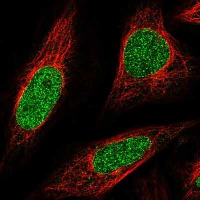 Immunocytochemistry/ Immunofluorescence: ABCA5 Antibody [NBP2-68798]