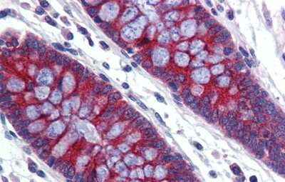 Immunohistochemistry-Paraffin: ABCA5 Antibody [NBP1-59809]