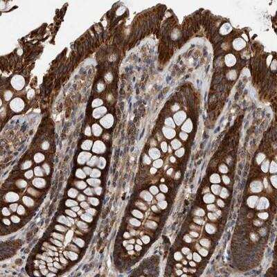 Immunohistochemistry-Paraffin: ABCA5 Antibody [NBP1-84780]