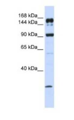 Western Blot: ABCA5 Antibody [NBP1-59809]