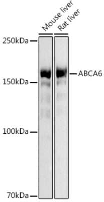 Western Blot: ABCA6 AntibodyAzide and BSA Free [NBP2-92497]