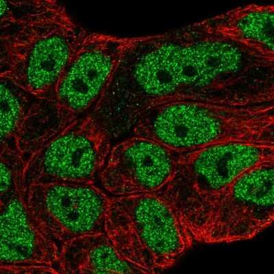 Immunocytochemistry/ Immunofluorescence: ABCA6 Antibody [NBP2-55225]