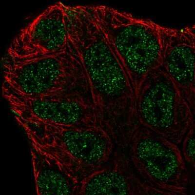 Immunocytochemistry/ Immunofluorescence: ABCA6 Antibody [NBP2-57372]