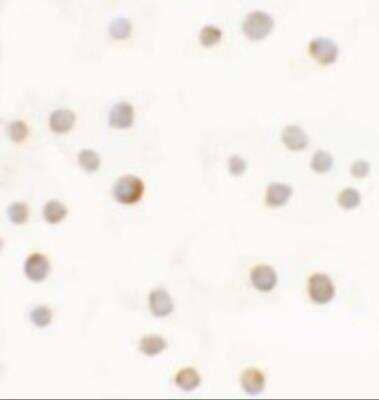 Immunocytochemistry/ Immunofluorescence: ABCA7 Antibody - BSA Free [NBP2-82069]