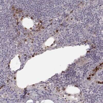 Immunohistochemistry-Paraffin: ABCA7 Antibody [NBP2-14250]