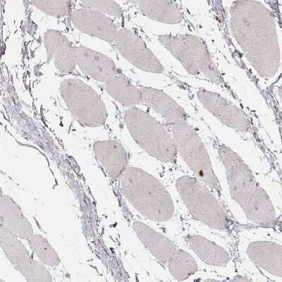 Immunohistochemistry-Paraffin: ABCA7 Antibody [NBP2-14250]