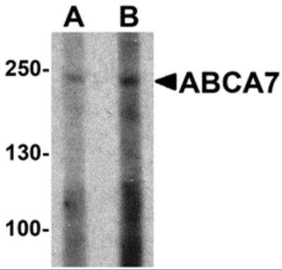 Western Blot: ABCA7 AntibodyBSA Free [NBP2-82069]