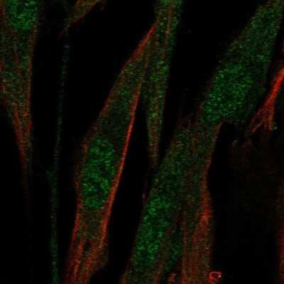 Immunocytochemistry/ Immunofluorescence: ABCA8 Antibody [NBP1-91641]