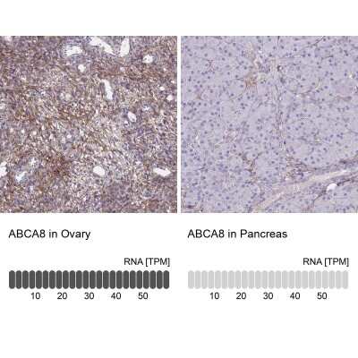 Immunohistochemistry-Paraffin: ABCA8 Antibody [NBP1-91641]