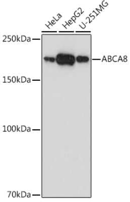 Western Blot: ABCA8 AntibodyAzide and BSA Free [NBP3-16046]