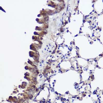 Immunohistochemistry-Paraffin: ABCA8A Antibody - Azide and BSA Free [NBP3-16029]