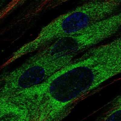 Immunocytochemistry/ Immunofluorescence: ABCA9 Antibody [NBP2-68700]