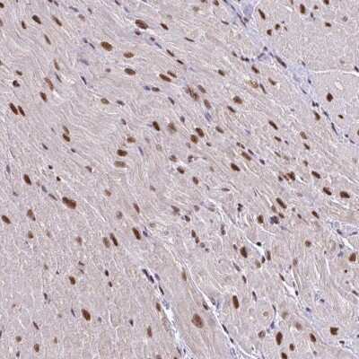 Immunohistochemistry-Paraffin: ABCA9 Antibody [NBP2-30843]