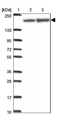 Western Blot: ABCA9 Antibody [NBP2-30843]