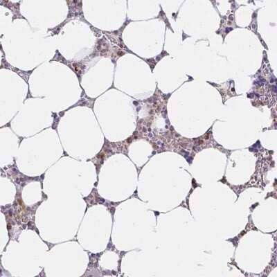 Immunohistochemistry: ABCB10 Antibody [NBP2-38749]