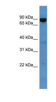 Western Blot: ABCB10 Antibody [NBP1-69065]