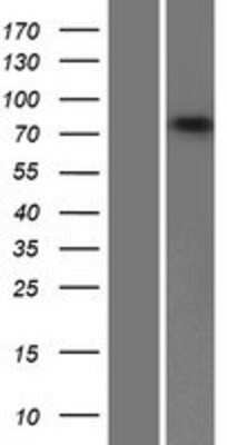 Western Blot: ABCB10 Overexpression Lysate [NBP2-07495]